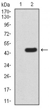 RAD23A Primary Antibody MP30907 [M1E4D6]