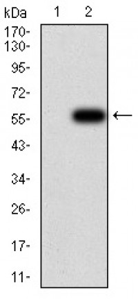 OTUD4 Primary Antibody MP30967 [M3B12G11]
