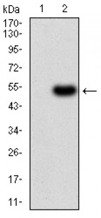 ALDH6A1 Primary Antibody MP30975 [M6H9B7]