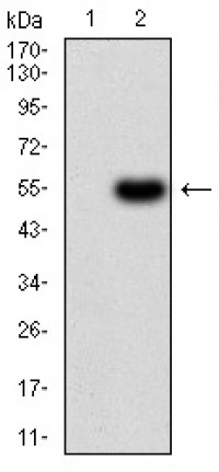 SERPINA1 Primary Antibody MP30983 [M6F9H11]