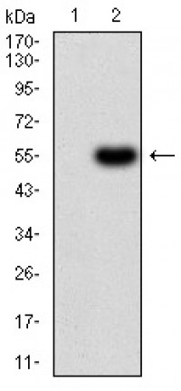 CFHR5 Primary Antibody MP30986 [M3A10A5]
