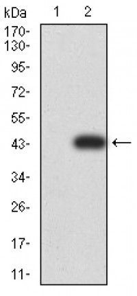 DNMT3A Primary Antibody MP31016 [M4G5F11]