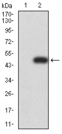 LGALS1 Primary Antibody MP31021 [M1H11C5]