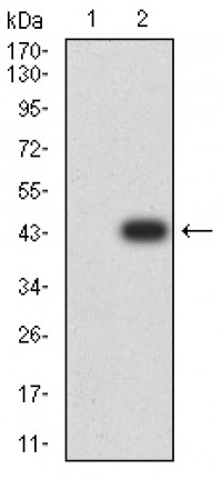 CD2 Primary Antibody MP31026 [M3D1E3]