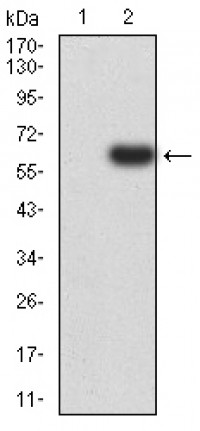 PTPN14 Primary Antibody MP31049 [M2C12E3]