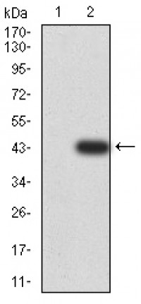 CD2 Primary Antibody MP31058 [M3D1B4]