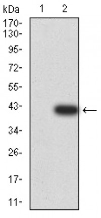 DDX1 Primary Antibody MP31065 [M3E5B2]