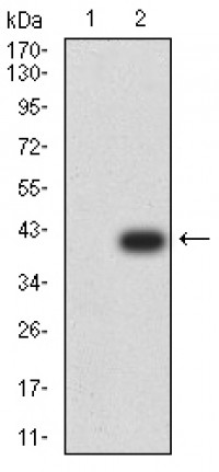 PRKAA2 Primary Antibody MP31179 [M5B4G1]