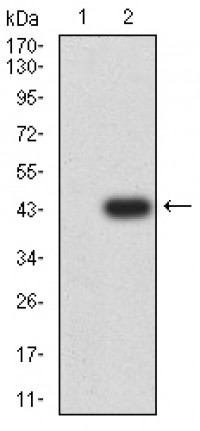 GRM5 Primary Antibody MP31259 [M1A11D10]