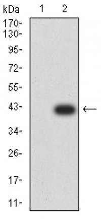 CTNNB1 Primary Antibody MP31277 [M7C5A2]