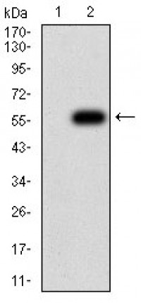 TNFSF11 Primary Antibody MP31304 [M8A7B9]