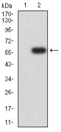 Dynamin-2 Primary Antibody MP31336 [M3F5C7]