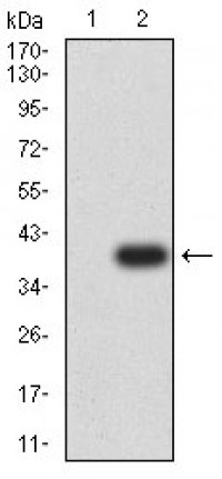 P2RY12 Primary Antibody MP31350 [M1C2A9]