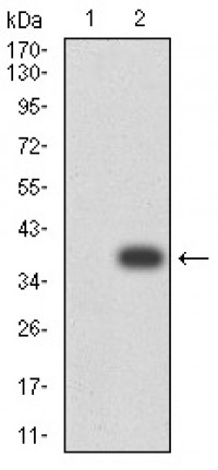 CD268 Primary Antibody MP31413 [M5A9B10]