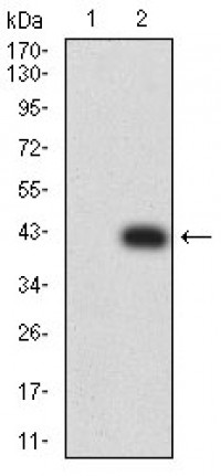 BTLA Primary Antibody MP31465 [M7H3E3]