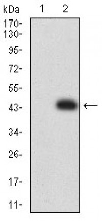 CD106 Primary Antibody MP31490 [M6A11D8]