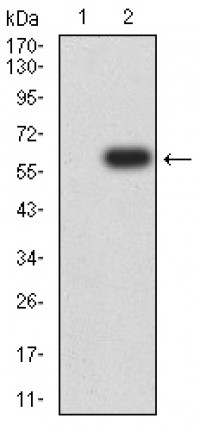 CD87 Primary Antibody MP31502 [M1D1B11]