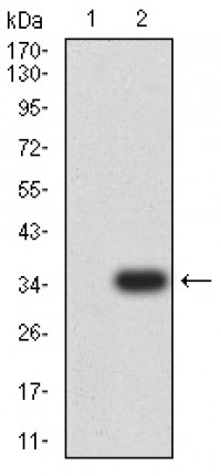 TNFRSF12A Primary Antibody MP31507  [M5C9B4]
