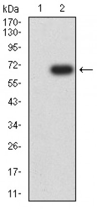 CD213A1 Primary Antibody  MP31567 [M8A3E3]