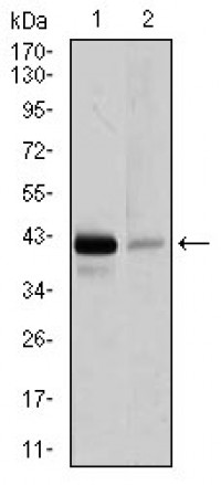 PAX5 Primary Antibody MP30379 [M1A7]