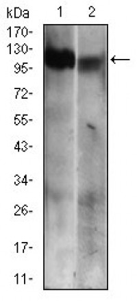 RB1 Primary Antibody MP30592 [M2A11D4]