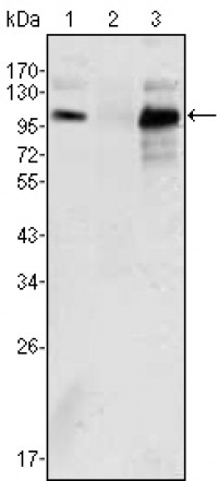 Androgen receptor Primary Antibody MP30007 [M2H8]