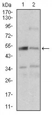 DAPK3 Primary Antibody MP30634 [M4H4C8]