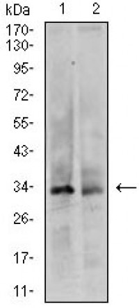 CDK4 Primary Antibody MP20445 [M4C5H9]