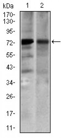 SLC27A5 Primary Antibody MP30454A [M4B11C10]