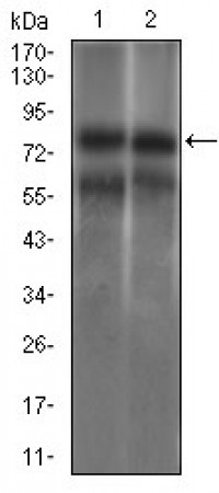 GUCY1A3 Primary Antibody  MP30467A [M3G6B2]