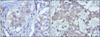 RTN3 Primary Antibody MP20357 [M10A8]