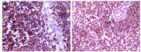 MAP2K4 Primary Antibody MP20097 [M2D10D8]