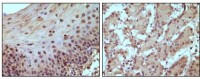 RB Primary Antibody MP20032 [M7E4B8]