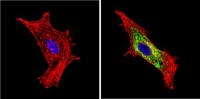 Anti-BACE1 / BACE Antibody MX-C355637
