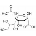 anti-HYAL1 antibody (Hyaluronidase-1) (N-Term)