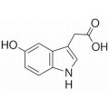 anti-HYAL1 antibody (Hyaluronidase-1) (N-Term)