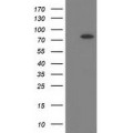 anti-HYAL1 antibody (Hyaluronidase-1) (N-Term)