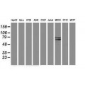 anti-HYAL1 antibody (Hyaluronidase-1) (N-Term)