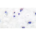 anti-HYAL1 antibody (Hyaluronidase-1) (N-Term)