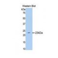 anti-HYAL1 antibody (Hyaluronidase-1) (N-Term)