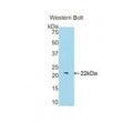 anti-HYAL1 antibody (Hyaluronidase-1) (N-Term)
