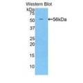 anti-HYAL1 antibody (Hyaluronidase-1) (N-Term)