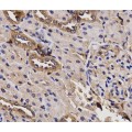 anti-HYAL1 antibody (Hyaluronidase-1) (N-Term)