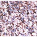 anti-HYAL1 antibody (Hyaluronidase-1) (N-Term)
