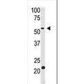 anti-HYAL1 antibody (Hyaluronidase-1) (N-Term)