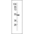 anti-HYAL1 antibody (Hyaluronidase-1) (N-Term)