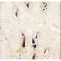 anti-HYAL1 antibody (Hyaluronidase-1) (N-Term)