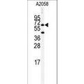 anti-HYAL1 antibody (Hyaluronidase-1) (N-Term)