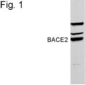 anti-HYAL1 antibody (Hyaluronidase-1) (N-Term)