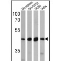 anti-HYAL1 antibody (Hyaluronidase-1) (N-Term)